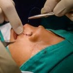 OMATAPALO apoia campanha de cirurgias gratuitas para crianças com lábio leporino na Huíla